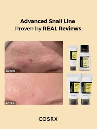 COSRX All About Snail Mucin - Set per la cura della pelle coreana, mini prodotti essenziali da viaggio, set regalo da viaggio con detergente viso, siero, crema idratante e crema per gli occhi alla bava di lumaca, kit ringiovanente - sandraperfume